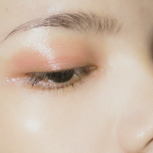 5 Ways to Improve Acne-Prone Skin Naturally
